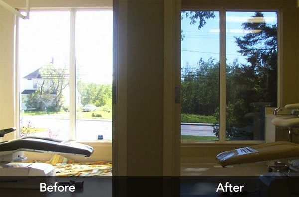 Before and After Film Window